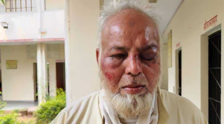 راجستھان میں ایک مسلم آٹو رکشا ڈرائیور کو ’’جے شری رام‘‘ کا نعرہ لگانے سے انکار پرنے تشدد کا نشانہ بنایا گیا، ملزمان گرفتار