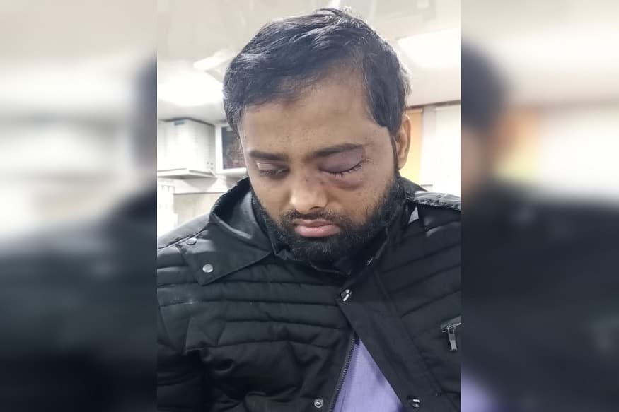 جامعہ پولس تشدد: ایک طالبِ علم بینائی سے محروم