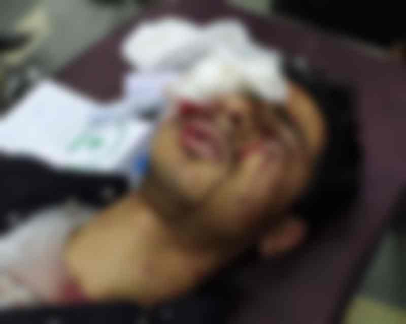 سرینگر: پولیس نے محرم کے جلوس میں شیعہ مسلمانوں پر چھرے فائر کیے، 30 سے زائد زخمی ہوگئے