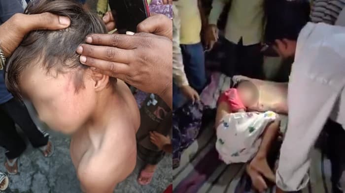 ہریدوار میں کلاس 1 کے مسلم لڑکے کی بے رحمی سے پٹائی،ہاتھ ٹوٹا
